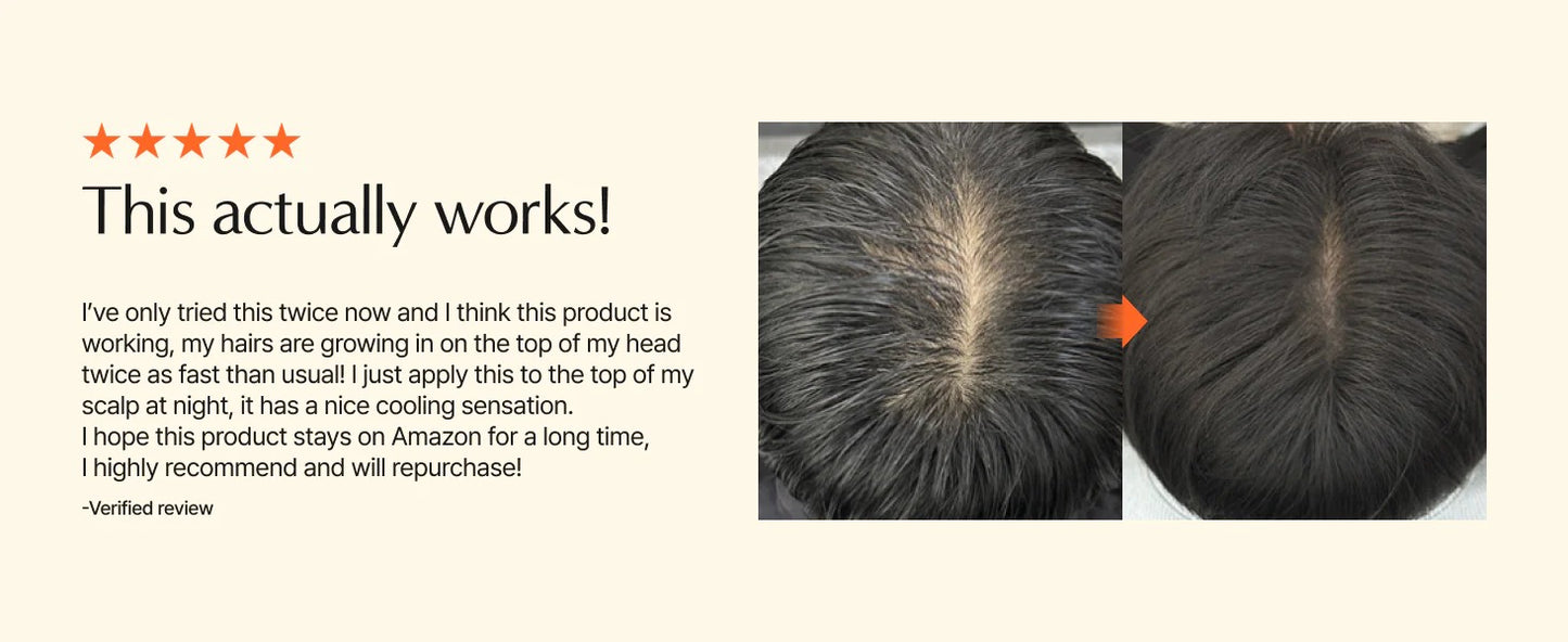 Growturn Hair Serum with Brush 100ml